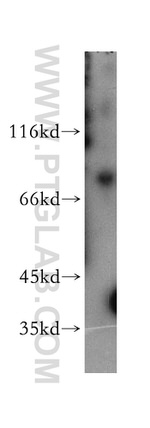 MDMX Antibody in Western Blot (WB)