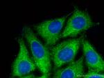 EIF4B Antibody in Immunocytochemistry (ICC/IF)