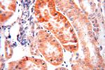 SNX5 Antibody in Immunohistochemistry (Paraffin) (IHC (P))