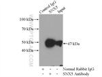 SNX5 Antibody in Immunoprecipitation (IP)