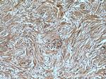 S100A5 Antibody in Immunohistochemistry (Paraffin) (IHC (P))