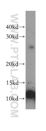 S100A5 Antibody in Western Blot (WB)