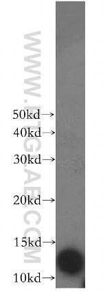 S100A5 Antibody in Western Blot (WB)