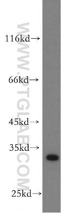 PTPRR Antibody in Western Blot (WB)