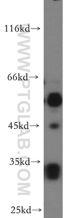 PTPRR Antibody in Western Blot (WB)