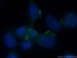 Galectin 9 Antibody in Immunocytochemistry (ICC/IF)