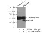 Galectin 9 Antibody in Immunoprecipitation (IP)