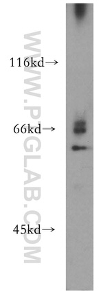 RPE65 Antibody in Western Blot (WB)