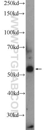 Neurokinin-1 receptor Antibody in Western Blot (WB)