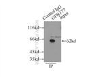 GPR177 Antibody in Immunoprecipitation (IP)