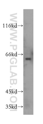 GPR177 Antibody in Western Blot (WB)
