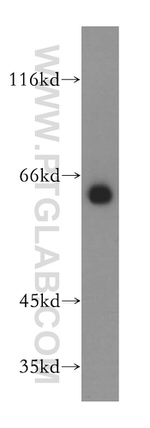 GPR177 Antibody in Western Blot (WB)