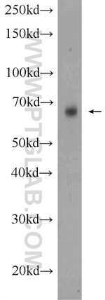 GPR177 Antibody in Western Blot (WB)