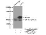 PD-L1/CD274 Antibody in Immunoprecipitation (IP)