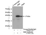 SRR Antibody in Immunoprecipitation (IP)