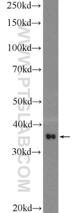 SRR Antibody in Western Blot (WB)