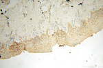 LOX Antibody in Immunohistochemistry (Paraffin) (IHC (P))