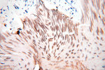 LOX Antibody in Immunohistochemistry (Paraffin) (IHC (P))