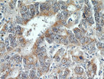 LOX Antibody in Immunohistochemistry (Paraffin) (IHC (P))