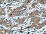 LOX Antibody in Immunohistochemistry (Paraffin) (IHC (P))