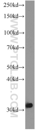 LOX Antibody in Western Blot (WB)