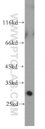 LOX Antibody in Western Blot (WB)