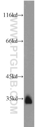 LOX Antibody in Western Blot (WB)