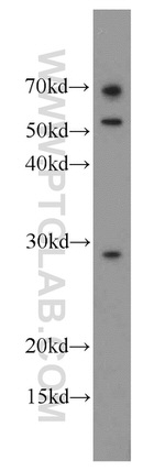 MIP Antibody in Western Blot (WB)