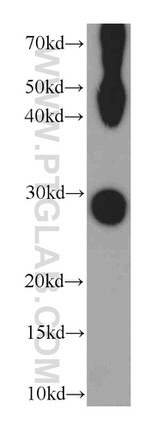 MIP Antibody in Western Blot (WB)