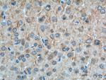 Cannabinoid receptor 1 Antibody in Immunohistochemistry (Paraffin) (IHC (P))