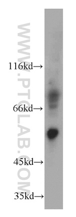 Cannabinoid receptor 1 Antibody in Western Blot (WB)