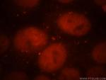 Cdc7 Kinase Antibody in Immunocytochemistry (ICC/IF)