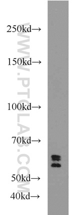 UGT8 Antibody in Western Blot (WB)