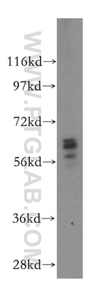 UGT8 Antibody in Western Blot (WB)