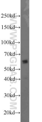 UGT8 Antibody in Western Blot (WB)