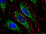 AIF Antibody in Immunocytochemistry (ICC/IF)