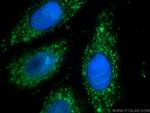 AIF Antibody in Immunocytochemistry (ICC/IF)