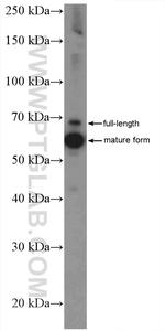 AIF Antibody in Western Blot (WB)