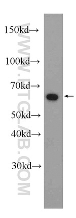 AIF Antibody in Western Blot (WB)