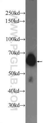 AIF Antibody in Western Blot (WB)