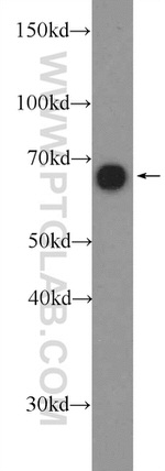 AIF Antibody in Western Blot (WB)