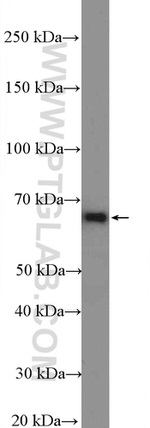 AIF Antibody in Western Blot (WB)