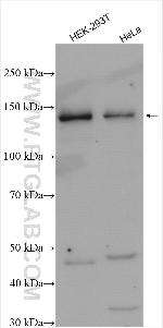 ADNP Antibody in Western Blot (WB)