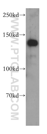 ADNP Antibody in Western Blot (WB)