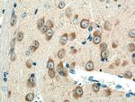 REEP1 Antibody in Immunohistochemistry (Paraffin) (IHC (P))