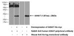 AANAT Antibody in Western Blot (WB)