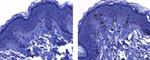 Mouse IgG1 Secondary Antibody in Immunohistochemistry (Paraffin) (IHC (P))