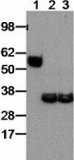 Rat IgG (H+L) Secondary Antibody in Western Blot (WB)