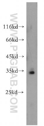 PPCS Antibody in Western Blot (WB)