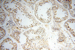 DNA polymerase beta Antibody in Immunohistochemistry (Paraffin) (IHC (P))